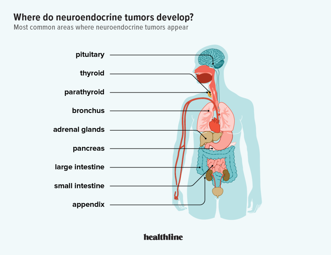 Neuroendocrine Disorders